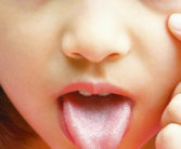舌头边缘有齿痕是什么原因