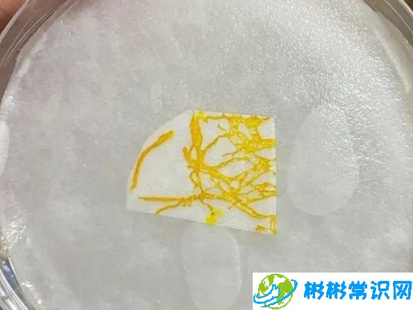 年轻人开始养黏菌当宠物，网友直呼‘脑洞大开’