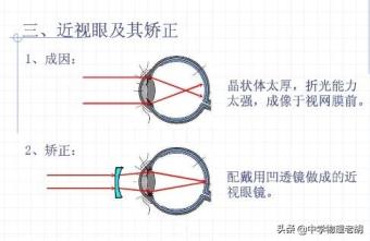 凸透镜和凹透镜是聚光还是散光(凸透镜和凹透镜)